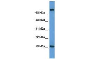 Image no. 1 for anti-Chemokine (C-C Motif) Ligand 20 (CCL20) (AA 31-80) antibody (ABIN6746017)