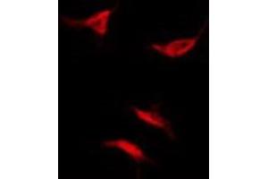 ABIN6279073 staining Hela by IF/ICC. (Acyp2 antibody  (Internal Region))