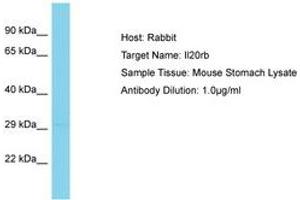 Image no. 1 for anti-Interleukin 20 Receptor beta (IL20RB) (AA 151-200) antibody (ABIN6750450) (IL20RB antibody  (AA 151-200))