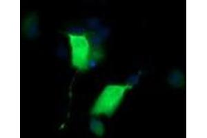 Image no. 2 for anti-Cancer/testis Antigen 1B (CTAG1B) antibody (ABIN1499902) (CTAG1B antibody)