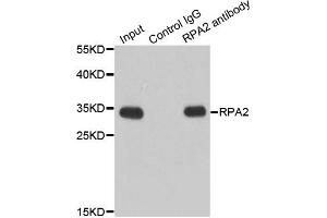 Immunoprecipitation analysis of 200ug extracts of Jurkat cells using 1ug RPA2 antibody. (RPA2 antibody)