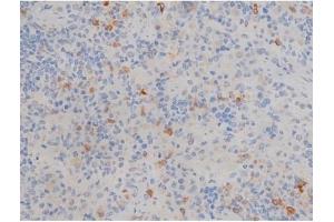 ABIN6256195 and ABIN6267353 at 1/200 staining Rat spleen tissue sections by IHC-P. (tau antibody  (pSer214))
