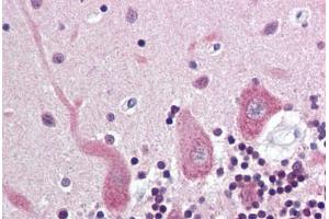 Human Brain, Cerebellum (formalin-fixed, paraffin-embedded) stained with Synuclein Alpha/Beta antibody ABIN337058 at 5-10 ug/ml followed by biotinylated anti-mouse IgG secondary antibody ABIN481714, alkaline phosphatase-streptavidin and chromogen. (Alpha, beta Synuclein antibody)