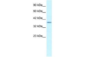 Human heart; WB Suggested Anti-SOX18 Antibody Titration: 0. (SOX18 antibody  (Middle Region))
