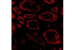 Immunofluorescence of Ski in human kidney tissue with this product at 20 μg/ml. (SKI antibody  (N-Term))