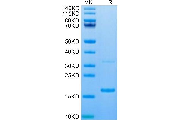S100A9 Protein (AA 1-130) (His tag)