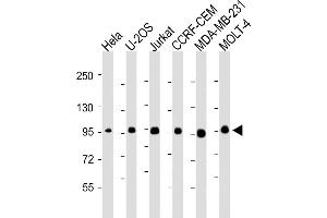All lanes : Anti-RANBP9 Antibody at 1:2000-1:4000 dilution Lane 1: Hela whole cell lysate Lane 2: U-2OS whole cell lysate Lane 3: Jurkat whole cell lysate Lane 4: CCRF-CEM whole cell lysate Lane 5: MDA-MB-231whole cell lysate Lane 6: MOLT-4 whole cell lysate Lysates/proteins at 20 μg per lane. (Importin 9 antibody  (AA 1-388))