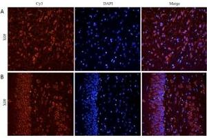 IHC staining of FFPE rat cerebral cortex [A] and rat hippocampus [B] with CHRNA antibody at 5ug/ml (CHRNA7 antibody)