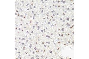 Immunohistochemistry (Paraffin-embedded Sections) (IHC (p)) image for anti-Polymerase (RNA) II (DNA Directed) Polypeptide B, 140kDa (POLR2B) (AA 1-260) antibody (ABIN6145916)