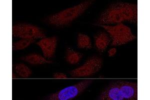 Confocal immunofluorescence analysis of U2OS cells using TAZ Polyclonal Antibody at dilution of 1:100 (60x lens). (TAZ antibody)