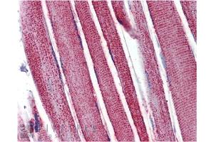 Immunohistochemistry analysis of human skeletal muscle tissue stained with Mn SOD, pAb at 10 μg/mL.