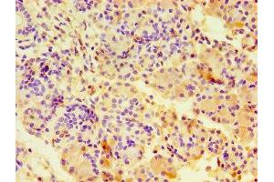 Immunohistochemistry of paraffin-embedded human pancreatic tissue using ABIN7146703 at dilution of 1:100 (CA12 antibody  (AA 25-301))