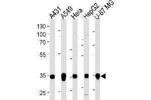 Western blot analysis of lysates from A431, A549, Hela, HepG2, U-87 MG cell line (from left to right), using MDH2 Antibody (C-term) (ABIN1537083 and ABIN2849638).