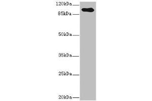 Western blot All lanes: TGFBR3 antibody IgG at 2. (TGFBR3 antibody  (AA 140-340))