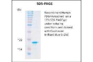 SDS-PAGE (SDS) image for Platelet Derived Growth Factor A (PDGFA) (Active) protein (ABIN5509326) (PDGFA Protein)
