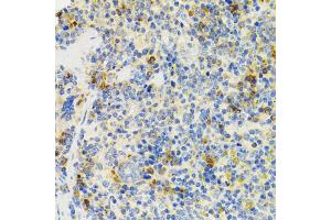 Immunohistochemistry of paraffin-embedded mouse spleen using SH2B1 Antibody (ABIN5973245) at dilution of 1/100 (40x lens). (SH2B1 antibody)
