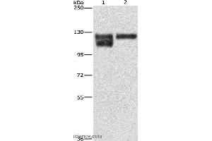 Western blot analysis of A172 cell and human leiomyosarcoma tissue, using ITGB1 Polyclonal Antibody at dilution of 1:600 (ITGB1 antibody)