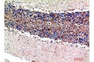 Immunohistochemistry (IHC) analysis of paraffin-embedded Human Brain, antibody was diluted at 1:200.