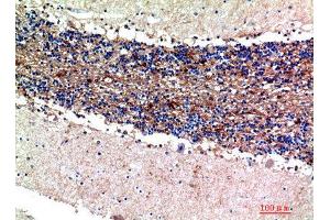 Immunohistochemistry (IHC) analysis of paraffin-embedded Human Brain, antibody was diluted at 1:200. (S100A1 antibody)