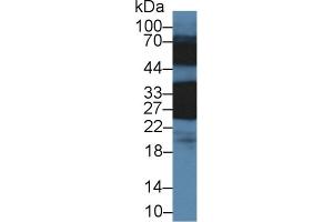 Detection of CRYbB1 in Rat Eye lysate using Polyclonal Antibody to Crystallin Beta B1 (CRYbB1)