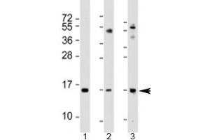 Western blot testing of 1) human A549 cell lysate, 2) mouse lung lysate and 3) mouse small intestine lysate with Phospholipase A2 antibody at 1:2000. (PLA2G1B antibody  (AA 32-62))
