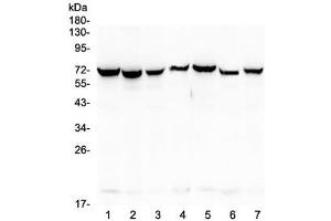 Western blot testing of human 1) HeLa, 2) COLO-320, 3) SW620, 4) A431, 5) A549, 6) HepG2 and 7) PANC-1 lysate with HSP70 antibody at 0. (HSP70 1A/ 1B antibody)