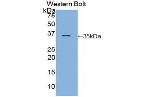 Detection of Recombinant CD1d, Rat using Polyclonal Antibody to Cluster Of Differentiation 1d (CD1d) (CD1d antibody  (AA 32-302))