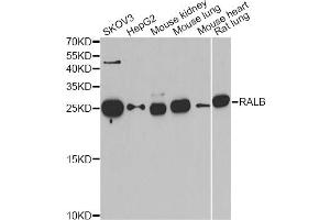Western blot analysis of extracts of various cell lines, using RALB antibody. (RALB antibody)