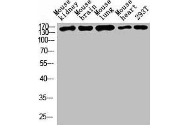 Desmoglein 1 antibody  (AA 30-90)