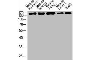 Western blot analysis of Mouse kidney tissue, Mouse brain tissue, Mouse lung tissue, Mouse heart tissue, 293T whole cell lysate, antibody was diluted at 1000.