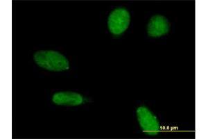 Immunofluorescence of purified MaxPab antibody to EMD on HeLa cell. (Emerin antibody  (AA 1-254))