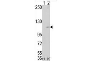 Western blot analysis of AOF2 (arrow) using LSD1 Antibody (Center) (ABIN388022 and ABIN2845464). (LSD1 antibody  (AA 457-490))