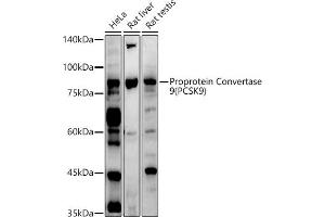 Western blot analysis of extracts of various cell lines, using Proprotein Convertase 9(PCSK9) antibody (ABIN6133851, ABIN6145328, ABIN6145330 and ABIN6223837) at 1:1000 dilution. (PCSK9 antibody  (C-Term))