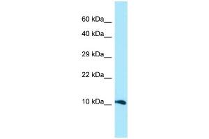 WB Suggested Anti-GGNBP1 Antibody Titration: 1.