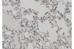 ABIN6273089 at 1/100 staining Rat lung tissue by IHC-P. (AEBP2 antibody  (Internal Region))