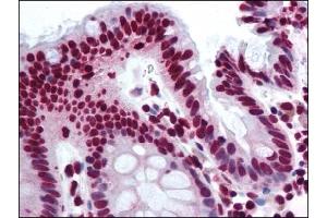 Image no. 1 for anti-Thyroid Hormone Receptor Associated Protein 3 (THRAP3) (AA 930-955) antibody (ABIN372266) (THRAP3 antibody  (AA 930-955))