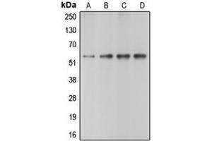 Western blot analysis of Caspase 10 expression in HeLa (A), Jurkat (B), mouse heart (C), rat heart (D) whole cell lysates.