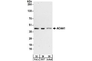 Western Blotting (WB) image for anti-Acetyl-CoA Acyltransferase 1 (ACAA1) (AA 50-100) antibody (ABIN7449937)