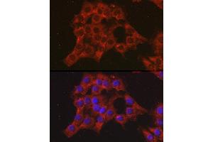 Immunofluorescence analysis of C6 cells using CCL3 Rabbit pAb (ABIN6130184, ABIN6138061, ABIN6138062 and ABIN6223474) at dilution of 1:100 (40x lens). (CCL3 antibody  (AA 24-92))