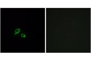 Immunofluorescence analysis of MCF7 cells, using GIPR Antibody. (GIPR antibody  (AA 93-142))