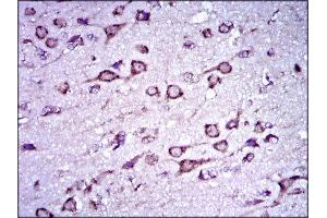 Immunohistochemistry (IHC) image for anti-Doublecortin (DCX) (AA 362-411) antibody (ABIN1844030) (Doublecortin antibody  (AA 362-411))