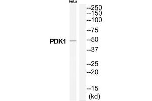 Western Blotting (WB) image for anti-3-phosphoinositide Dependent Protein Kinase-1 (PDPK1) (Internal Region) antibody (ABIN1851912) (PDPK1 antibody  (Internal Region))