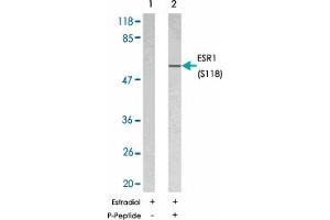 Western blot analysis of extracts from MCF7 cells using ESR1 (phospho S118) polyclonal antibody . (Estrogen Receptor alpha antibody  (pSer118))