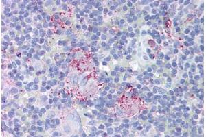 Human Thymus (formalin-fixed, paraffin-embedded) stained with MTBP antibody ABIN213954 at 10 ug/ml followed by biotinylated goat anti-rabbit IgG secondary antibody ABIN481713, alkaline phosphatase-streptavidin and chromogen. (MTBP antibody  (AA 122-139))