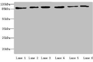 Western blot All lanes: MCM3 antibody at 4 μg/mL Lane 1: Hela whole cell lysate Lane 2: 293T whole cell lysate Lane 3: K562 whole cell lysate Lane 4: HepG2 whole cell lysate Lane 5: Jurkats whole cell lysate Lane 6: U917 whole cell lysate Secondary Goat polyclonal to rabbit IgG at 1/10000 dilution Predicted band size: 91, 96 kDa Observed band size: 91 kDa (MCM3 antibody  (AA 1-295))