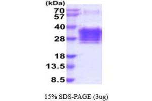 SDS-PAGE (SDS) image for Orosomucoid 2 (ORM2) (AA 19-201) protein (His tag) (ABIN5854831)