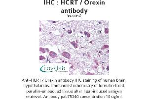 Image no. 1 for anti-Orexin (OX) antibody (ABIN1735350) (Orexin antibody)