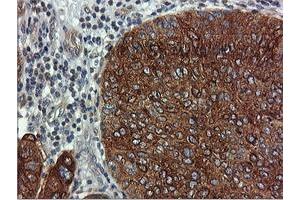 Image no. 1 for anti-Farnesyl-Diphosphate Farnesyltransferase 1 (FDFT1) antibody (ABIN1498243) (FDFT1 antibody)