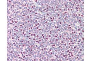 Anti-RAD51B antibody IHC staining of human tonsil. (RAD51 Homolog B antibody  (AA 143-192))