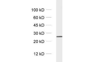 dilution: 1 : 1000, sample: crude synaptosomal fraction of rat brain (P2) (RAB5 antibody)